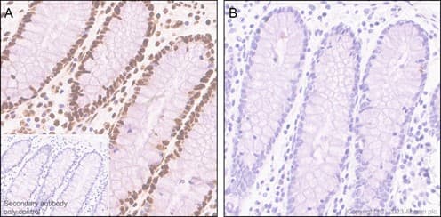 Anti-RNA polymerase II CTD repeat YSPTSPS (phospho S5) antibody [EP1510Y](AB76292)
