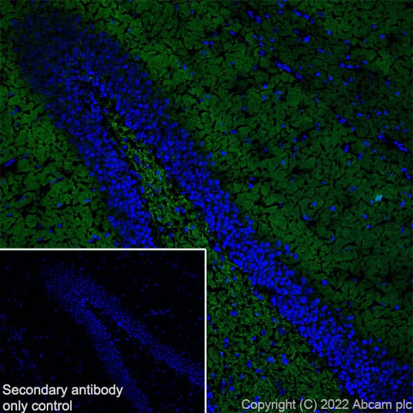 Anti-Bassoon/BSN antibody [L124-59](AB306593)