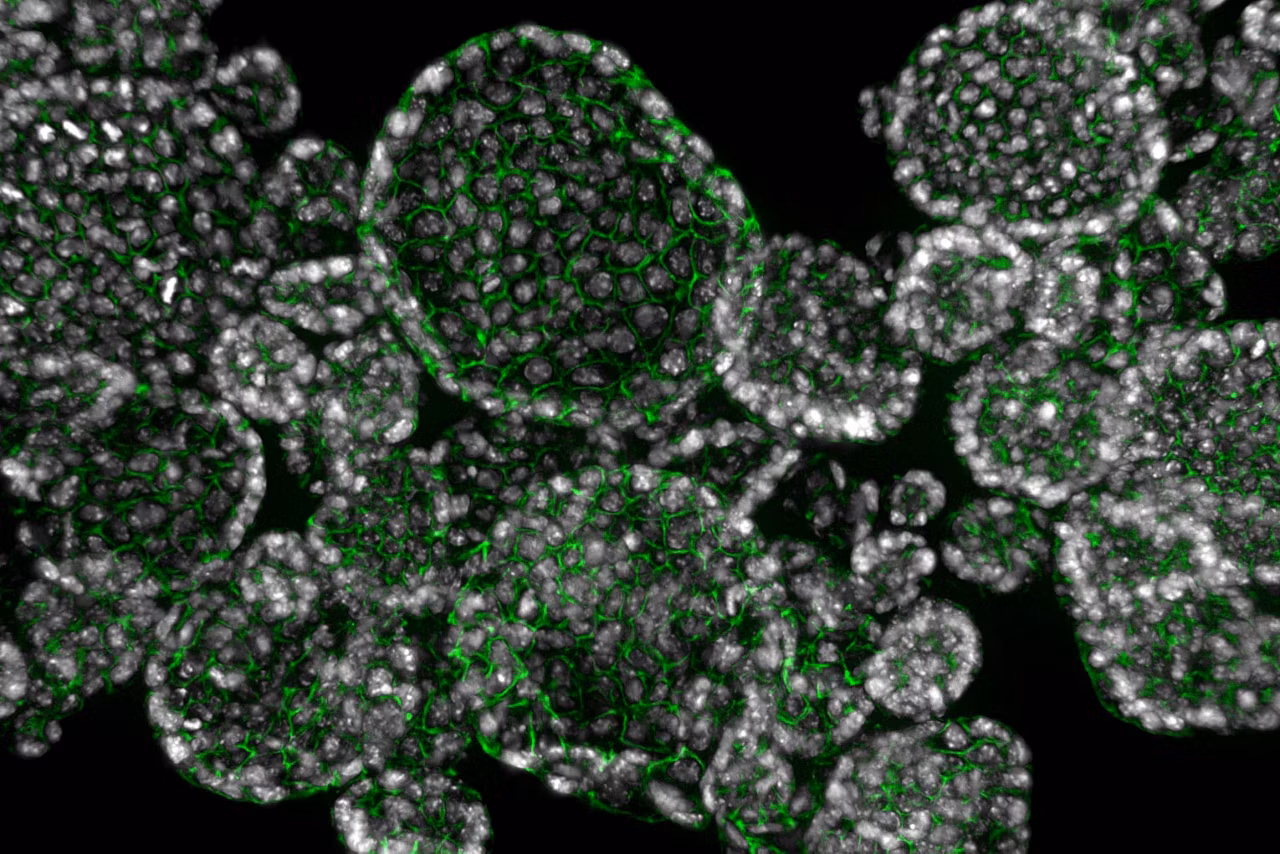 THUNDER Imager Organoid Cluster 1530 Kid21776101