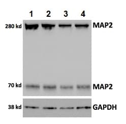 Anti-MAP2 antibody - Neuronal Marker(AB32454)