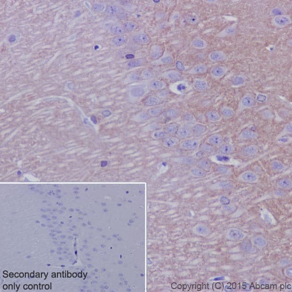 Anti-Kappa Opioid Receptor antibody [EPR18881] - BSA and Azide free(AB240278)