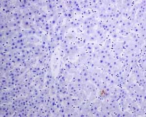 Il 2 Receptor Alpha Antibody Epr6452 Ab128955  Immunohistochemistry Formalin Pfa Fixed Paraffin Embedded Sections Img134751
