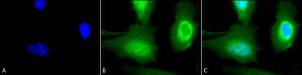 Anti-Calreticulin antibody(AB223614)