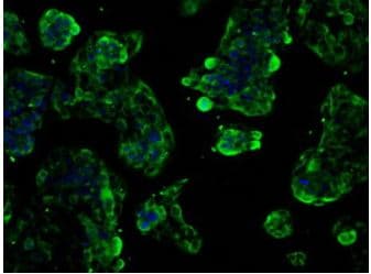 Anti-GLUT5 antibody [OTI20E1](AB279363)