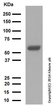 Anti-Cytokeratin 10 antibody [EP1607IHCY] - Cytoskeleton Marker(AB76318)