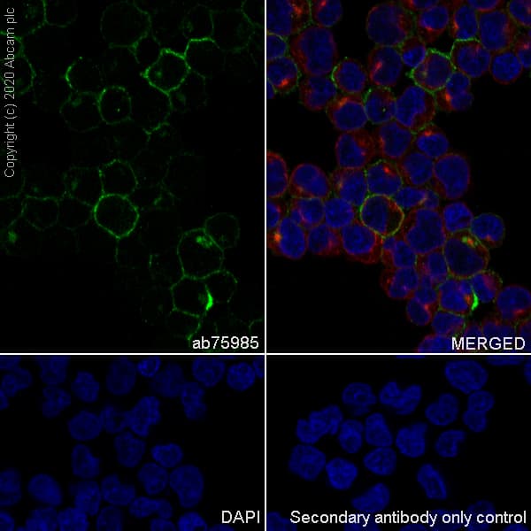 Cd21 Antibody Ep3093 Bsa And Azide Free Ab271855  Immunocytochemistry Immunofluorescence Img170121