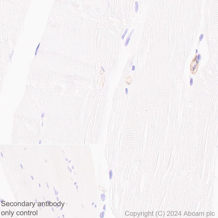 Anti-HLA Class 1 abC antibody [EMR8-5](ab70328)