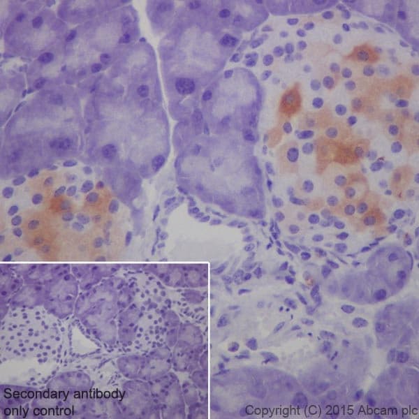 Anti-GAD65 + GAD67 antibody [EPR19366](AB183999)