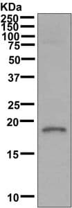 Anti-Myelin Basic Protein antibody [EPR6652](AB133620)
