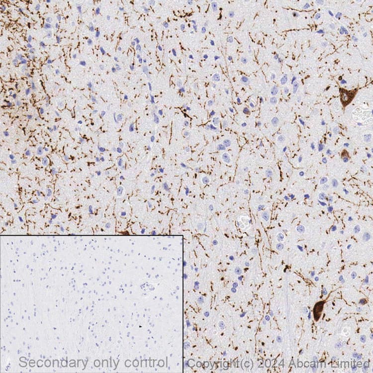 Anti-Tyrosine Hydroxylase antibody [EP1532Y] - Neuronal Marker(AB137869)
