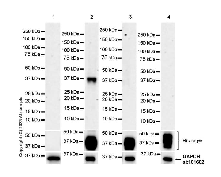 Anti-Mycobacterium tuberculosis Ag85B antibody [EPR28401-54] - BSA and Azide free(AB312329)