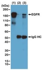 Phosphotyrosine Antibody Rm111 Ab190824  Immunoprecipitation Img11066