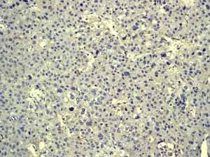 Anti-Cytokeratin 20 antibody [EPR1622Y] - BSA and Azide free(AB219589)