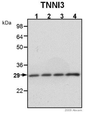 Anti-Cardiac Troponin I antibody(AB47003)