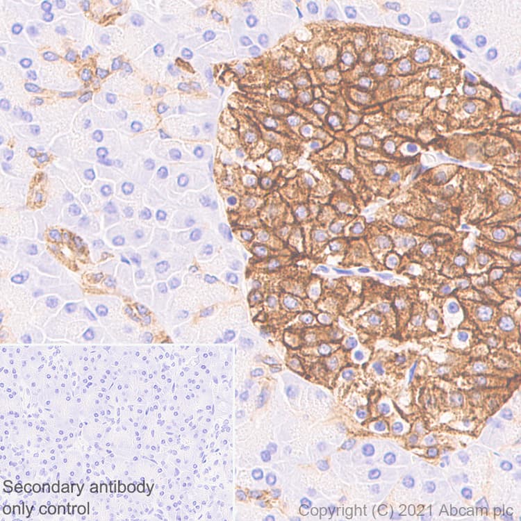 Casr Antibody Epr24050 59 Bsa And Azide Free Ab280360  Immunohistochemistry Formalin Pfa Fixed Paraffin Embedded Sections Img54915