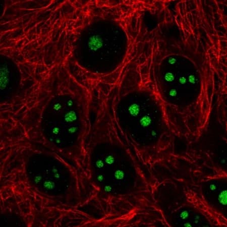 Anti-NIFK antibody [CL2240] - Nucleolar Marker(AB211871)