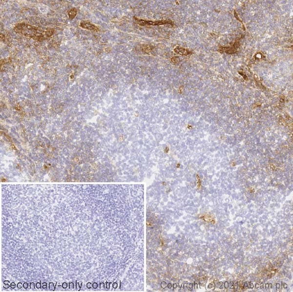 Cd39 Antibody Ac2 Ab97552  Immunohistochemistry Frozen Sections Img180843