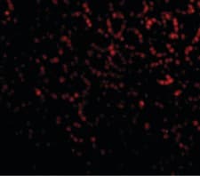 Phap1 Antibody C Terminal Ab189110  Immunocytochemistry Immunofluorescence Img29730