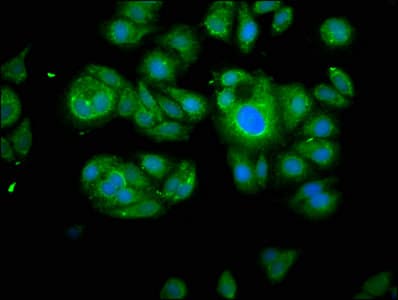 Calpain 2 Antibody Ab236650  Immunocytochemistry Immunofluorescence Img59257