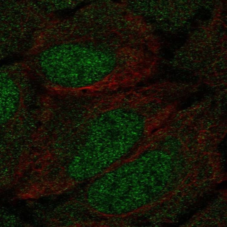 Anti-DCAMKL1 antibody(AB262845)