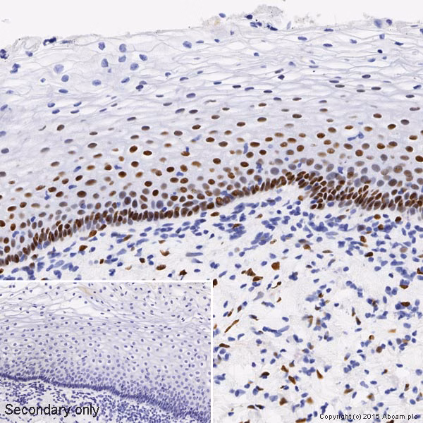 IHC image of estrogen receptor alpha in normal human cervix tissue.