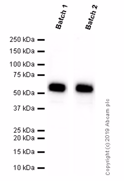 Western blot of rat skin lysate stained with anti-Cytokeratin 5 antibody (ab52635), showing a band at the expected 62 kDa size.