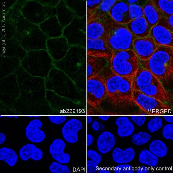 Anti-BCRP/ABCG2 antibody [EPR21122](AB229193)