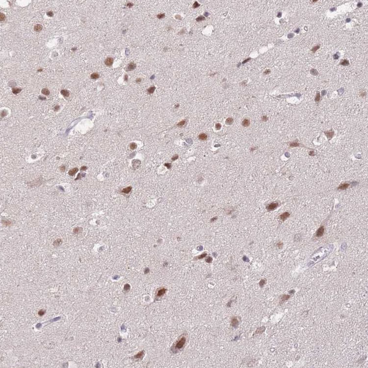 Anti-PUS10 antibody(AB185078)