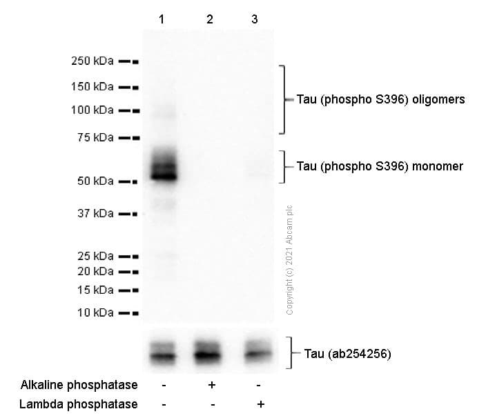 Anti-Tau (phospho S396) antibody [E178](ab32057)