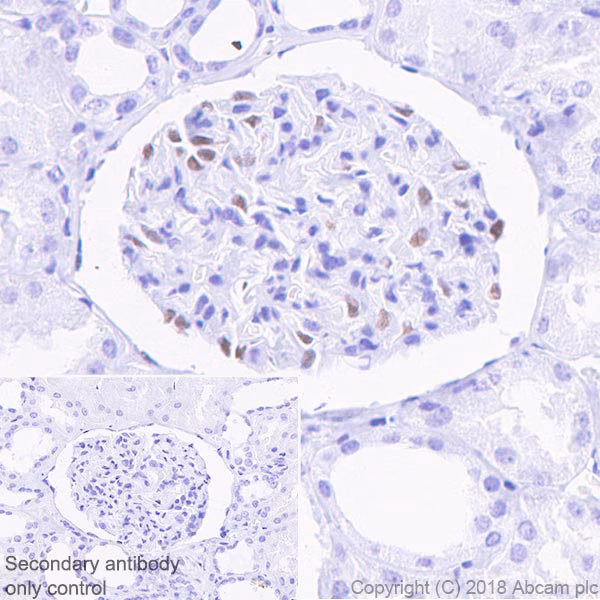 ab89901 staining wilms tumor protein in paraffin-embedded human kidney tissue sections by Immunohistochemistry.