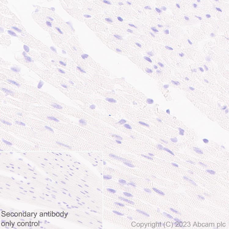 Anti-GPCR GPR17 antibody [EPR26423-34](AB316105)
