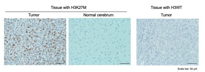 Anti-Histone H3 (mutated K27M) antibody [EPR18340] - ChIP Grade(AB190631)