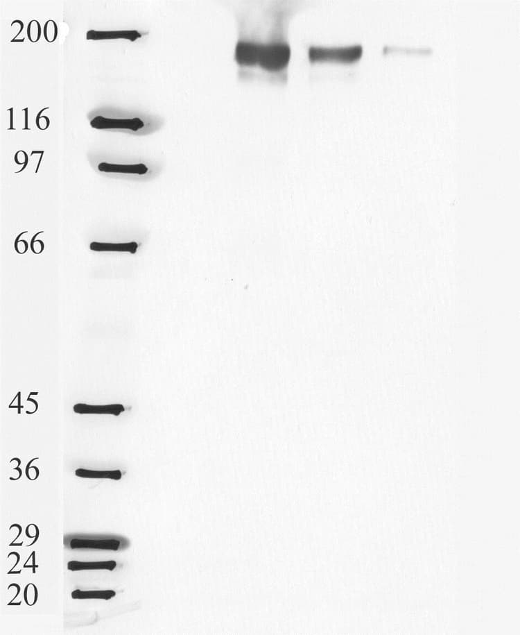 Anti-Angiotensin Converting Enzyme 1 antibody(ab28311)
