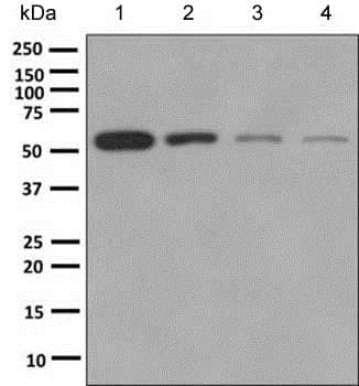 Anti-ETV3 antibody [EPR8658](AB154810)