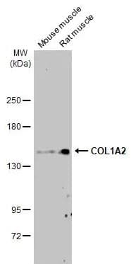 Col1a2 Antibody Hl2049 Ab308221  Western Blot Img407094