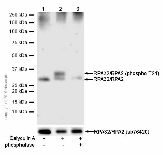 Anti-RPA32/RPA2 (phospho T21) antibody [EPR2846(2)](AB109394)