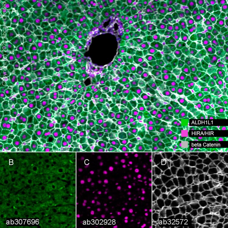 Anti-beta Catenin antibody [E247] - ChIP Grade(AB32572)