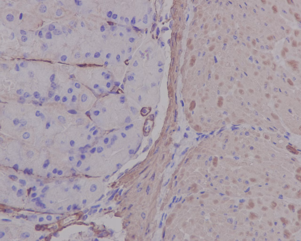 Immunohistochemistry of formalin-fixed mouse stomach tissue, labeling alpha smooth muscle Actin with antibody ab124964 at 1/1000 dilution