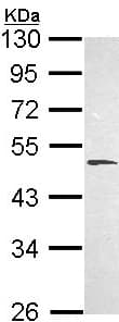 Hyal1 Antibody Ab103977  Western Blot Img27958