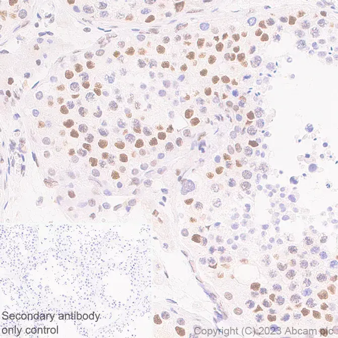 Anti-METTL16 antibody [EPR27236-78](AB313743)