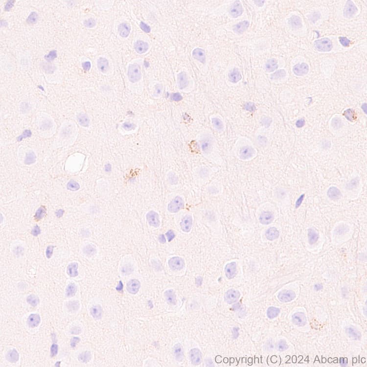 Anti-Slc25a1 antibody [EPR29193-92](AB318201)