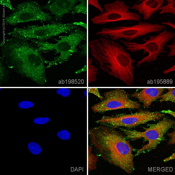 Alexa Fluor 488 Ezrin Antibody Ep886y Ab198520  Immunocytochemistry Immunofluorescence Img105286