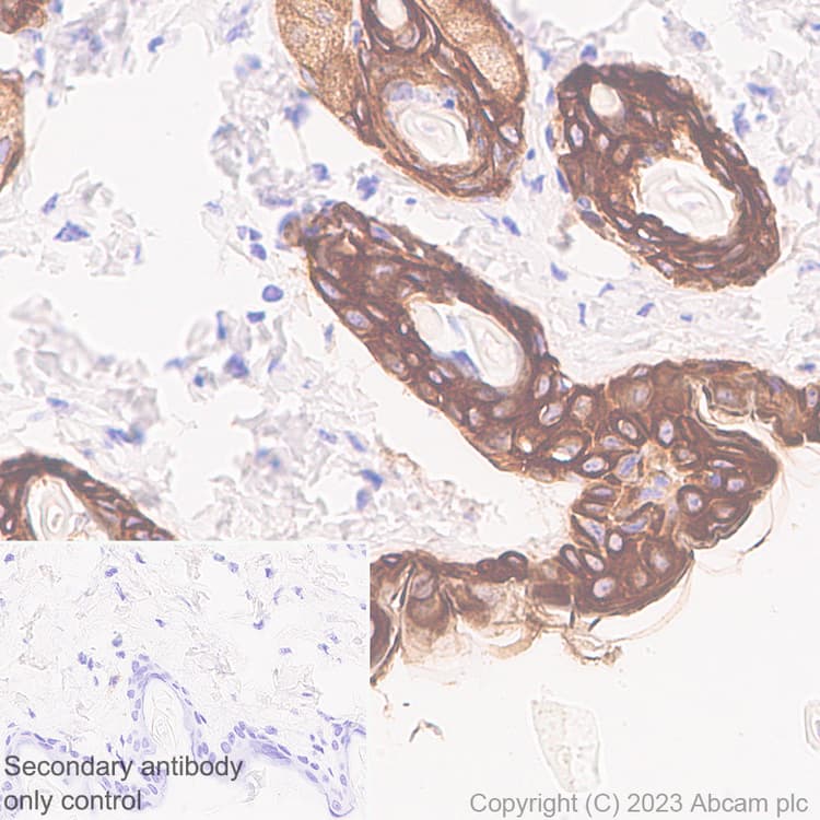 Pan Cytokeratin Antibody Epr28285 45 Bsa And Azide Free Ab308263  Immunohistochemistry Formalin Pfa Fixed Paraffin Embedded Sections Img408894