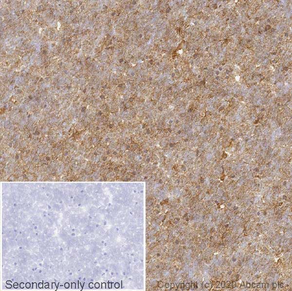 IHC image of S100 beta staining in normal human cerebral cortex.