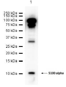 Anti-S100 alpha antibody [EPR5251](AB109384)