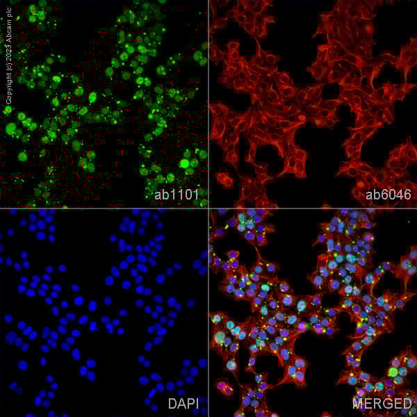 Anti-beta Tubulin antibody - Loading Control(AB6046)