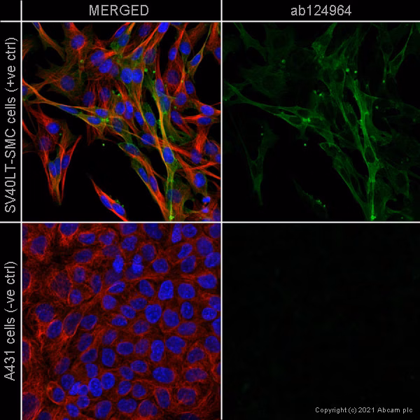 AB124964 staining of alpha smooth muscle Actin in SV40LT-SMC cells (positive control, top panel) and A431 cells (negative control, bottom panel)