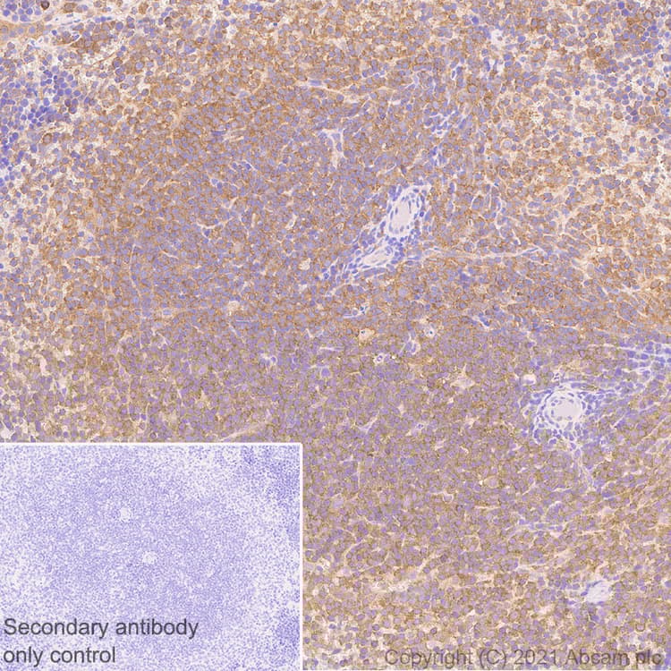 Anti-NF-kB p65 antibody [E379](AB32536)