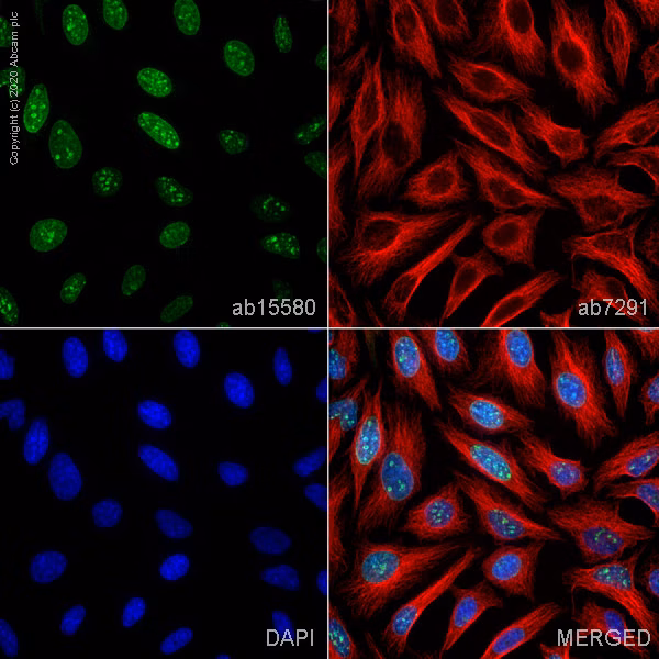 Ki67 staining in HeLa cells showing nuclear localization (green), alpha tubulin (red), and nuclear DNA (blue).