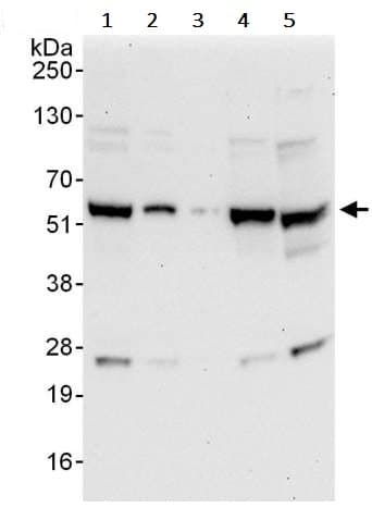 Anti-YY1 antibody(AB245365)